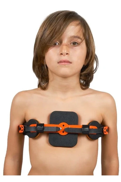 MEDİKALCİM WP953 Pectus Carinatum Ortezi Dinamik (Güvercin Göğsü) ürün görseli 1