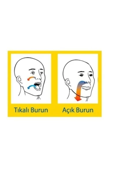 Smart Nozovent Horlama Önleyici Burun Açıcı Rahat Nefes Aparatı-orta Boy ürün görseli 1