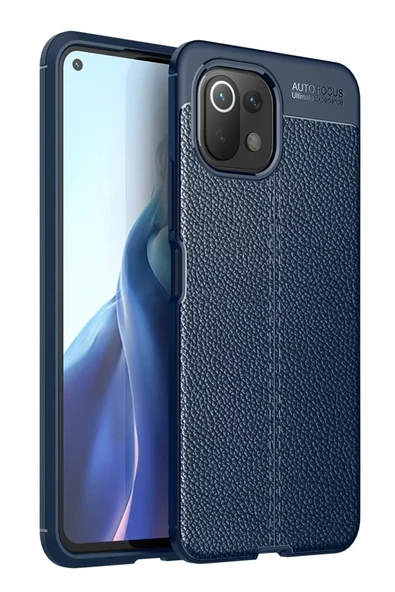 Newface Xiaomi Mİ 11 Lite Kılıf Auto Focus Kapak - Lacivert ürün görseli 1