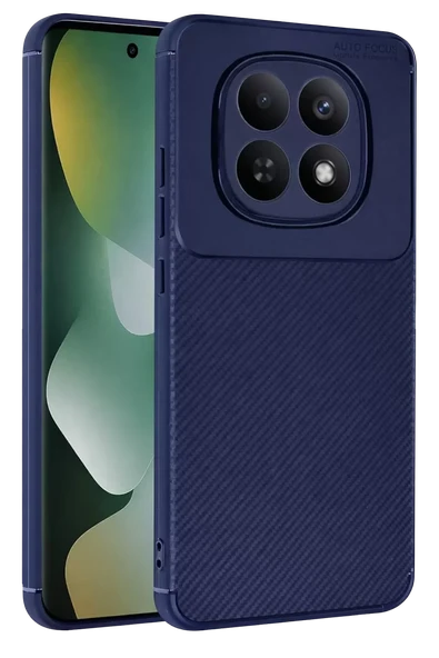 Newface Xiaomi Redmi Note 15 Pro Plus 5G Auto Focus Karbon Kapak - Lacivert ürün görseli 1