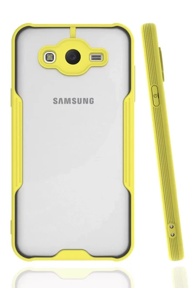 Newface Samsung Galaxy J7 Kılıf Platin Silikon - Sarı ürün görseli 1