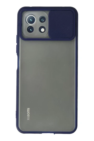 Newface Xiaomi Mİ 11 Lite Kılıf Palm Buzlu Kamera Sürgülü Silikon - Lacivert ürün görseli 1