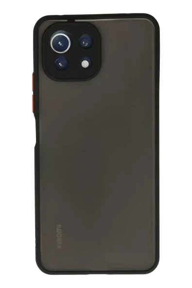 Newface Xiaomi Mİ 11 Lite Kılıf Montreal Silikon Kapak - Siyah ürün görseli 1