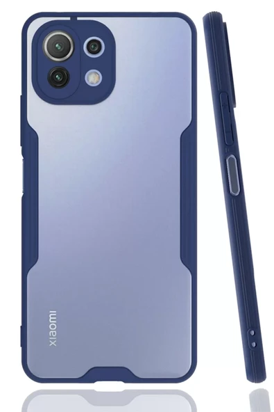 Newface Xiaomi Mİ 11 Lite Kılıf Platin Silikon - Lacivert ürün görseli 1