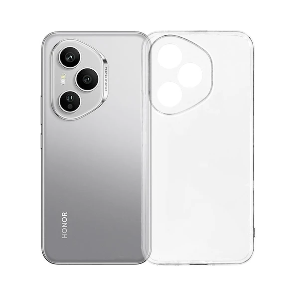 Honor 400 Kılıf Kamera Korumalı Silikon Lux Şeffaf Kapak ürün görseli 1