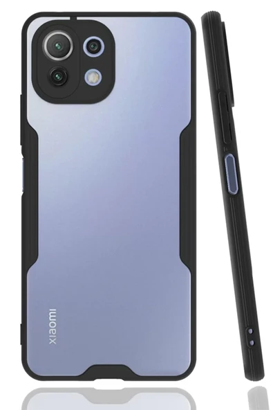 Newface Xiaomi Mİ 11 Lite Kılıf Platin Silikon - Siyah ürün görseli 1