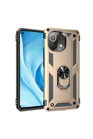 Newface Xiaomi Mİ 11 Lite Kılıf Sofya Yüzüklü Silikon Kapak - Gold ürün görseli 1