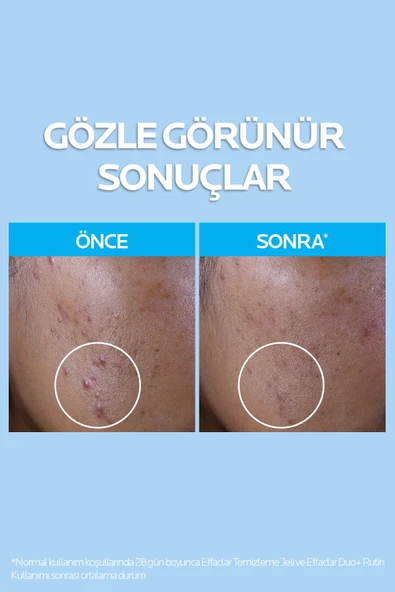 La Roche Posay Effaclar Gel 400 Ml - Resim 4