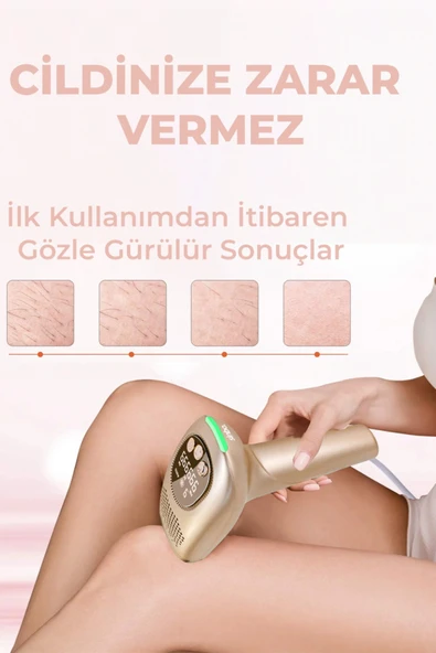 Sinbo SEL-6044 IPL Buz Lazer Epilasyon 999.999 Atım Otomatik/Manuel Dijital Ekran ürün görseli 1