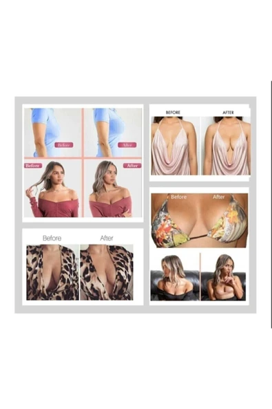 BEAUTY BOX COSMETIC Sıkı Göğüsler 5cm*5m Ten Rengi Suya Dayanıklı Göğüs Bandı Boob Tape Kinezyoloji Bandı ürün görseli 1