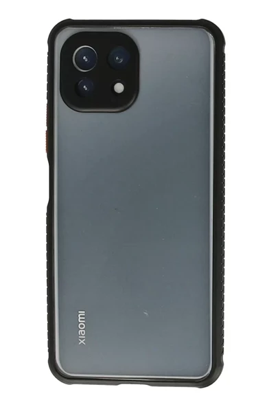 Newface Xiaomi Mİ 11 Lite Kılıf Miami Şeffaf Silikon - Siyah ürün görseli 1