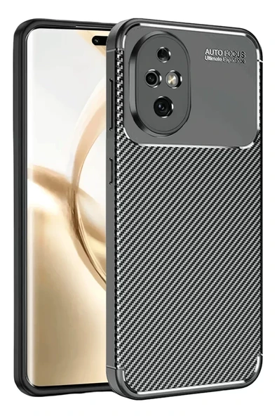 Newface Honor 200 Kılıf Auto Focus Karbon Kapak - Siyah ürün görseli 1