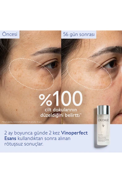Caudalie - Vinoperfect Esans 100 Ml - Resim 3