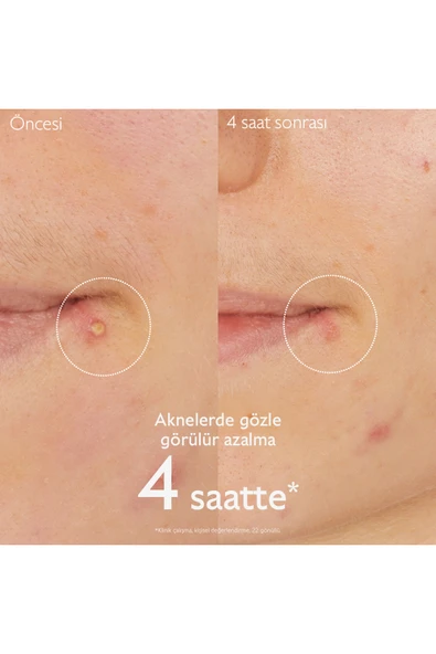 Caudalie Vinopure Salicylic Spot Solution 15 ml - Resim 3