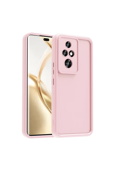 HEPTEKİLETİŞİM Honor 200 Pro Kılıf Mat Yüzeyli Kamera Korumalı Silikon Kapak (Ananas) ürün görseli 1