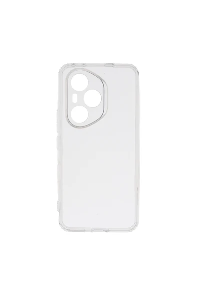 HEPTEKİLETİŞİM Honor 400 Pro Kılıf Darbe Emici Kamera Korumalı Şeffaf Silikon Kapak (02-ANTİ) ürün görseli 1