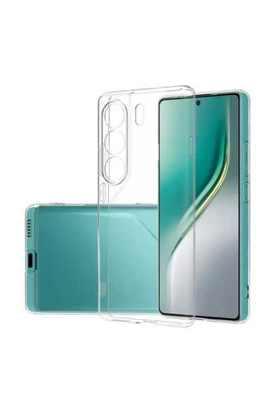 HEPTEKİLETİŞİM Tecno Camon 40 Pro Şeffaf Kılıf Yumuşak Ince Tasarımlı Kapak (süper) ürün görseli 1