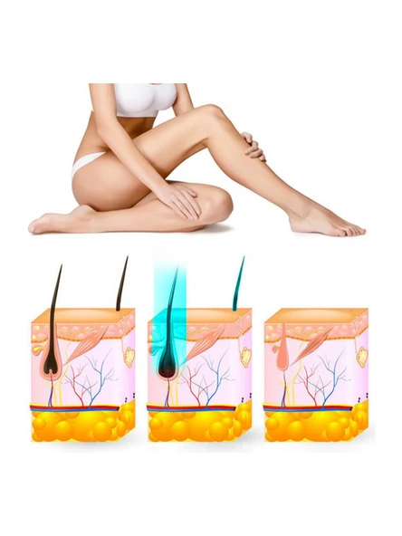 Yui IPLV15 Pro Buz Başlıklı Rosegold Lazer Epilasyon Aleti ürün görseli 1