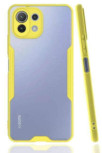 Newface Xiaomi Mİ 11 Lite Kılıf Platin Silikon - Sarı ürün görseli 1