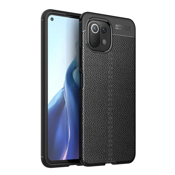 Xiaomi Mi 11 Lite Kılıf Auto Focus Kapak - Siyah ürün görseli 1