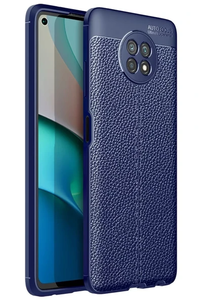 Newface Xiaomi Redmi Note 9 5G Kılıf Auto Focus Kapak - Lacivert ürün görseli 1