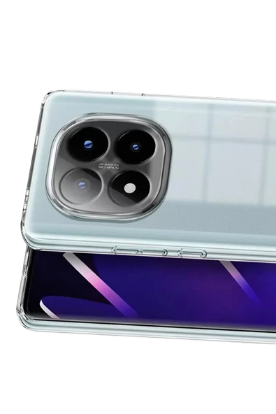 Newface Xiaomi Redmi Note 15 Pro Plus 5G Lüx Şeffaf Silikon - Şeffaf - Resim 3