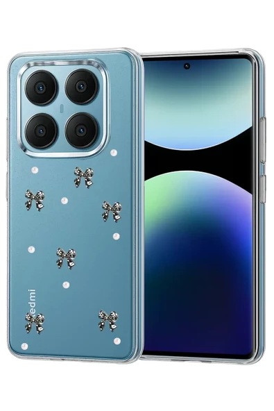 Newface Xiaomi Redmi Note 14 Pro 4G Fiyonk Desenli Kapak - Desen 8 ürün görseli 1