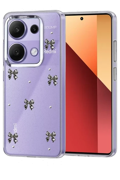 Newface Xiaomi Redmi Note 13 Pro 4G Fiyonk Desenli Kapak - Desen 5 ürün görseli 1