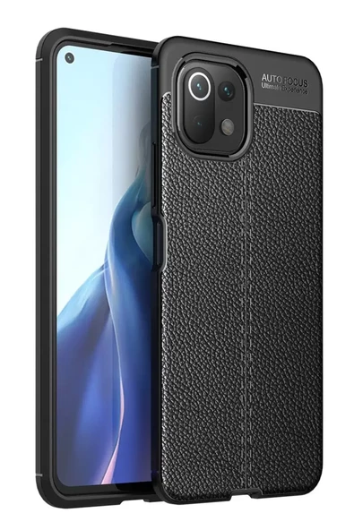 Newface Xiaomi Mİ 11 Lite Kılıf Auto Focus Kapak - Siyah ürün görseli 1