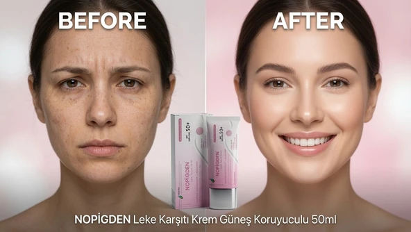 Nopigden Leke Karşıtı Güneş Koruyuculu Yüz Kremi 50 ml Günlük Cilt Bakım Nemlendirici Krem ürün görseli 1