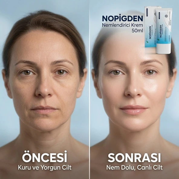 Nopigden Nemlendirici Onarıcı Krem 50 ml Günlük Cilt Bakım ve Nemlendirme Kremi ürün görseli 1