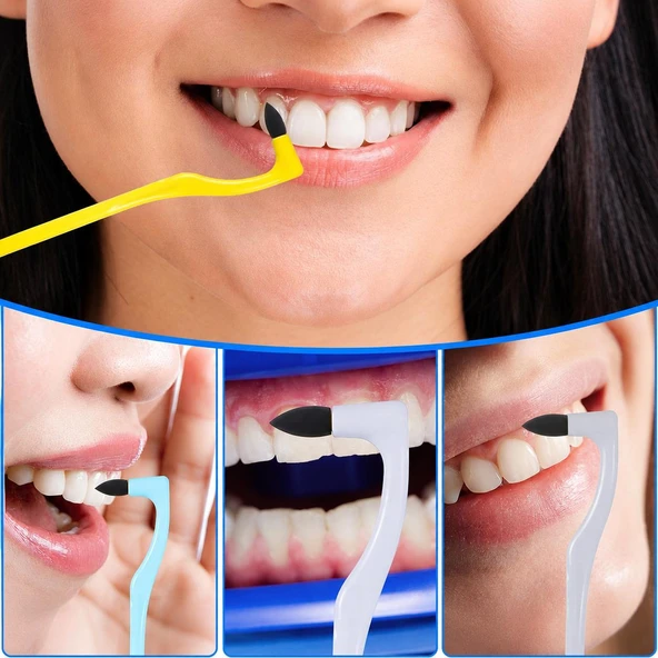 3B Trend Diş Leke Temizleyici Silgi Fırçası – Diş Yüzeyi Plak ve Sigara Lekesi Temizleme Aparatı ürün görseli 1