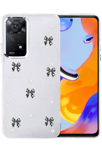 Newface Xiaomi Redmi Note 11 Pro Fiyonk Desenli Kapak - Desen 8 ürün görseli 1