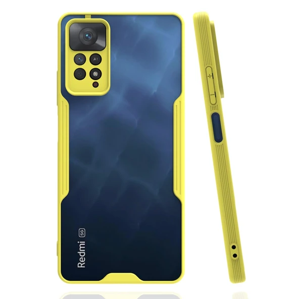 Xiaomi Redmi Note 11 Pro Kılıf Platin Silikon - Sarı ürün görseli 1