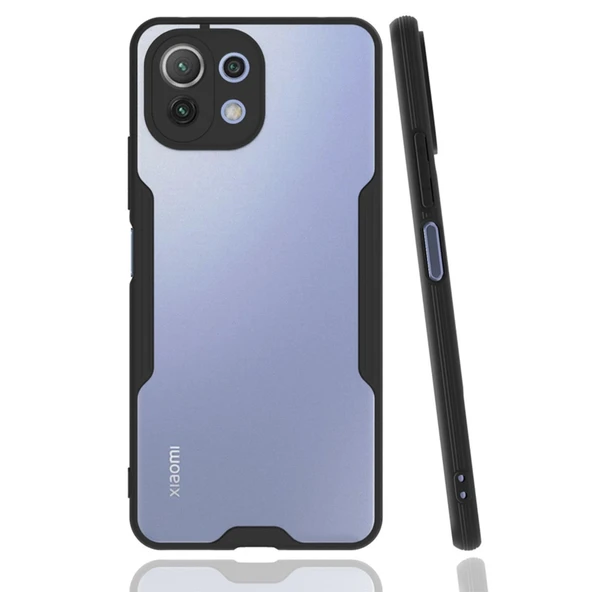 Xiaomi Mi 11 Lite Kılıf Platin Silikon - Siyah ürün görseli 1
