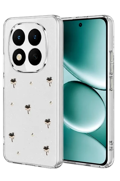 Newface Xiaomi Redmi Note 15 4G Fiyonk Desenli Kapak - Desen 1 ürün görseli 1