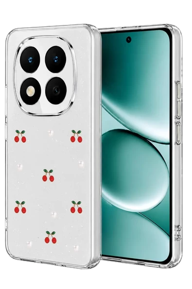 Newface Xiaomi Redmi Note 15 Pro 4G Fiyonk Desenli Kapak - Desen 9 ürün görseli 1