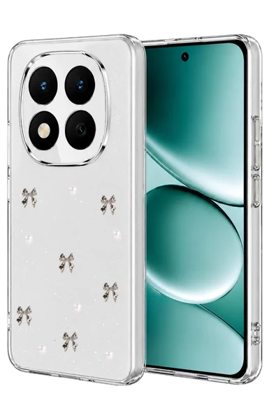 Newface Xiaomi Redmi Note 15 Pro Plus 5G Fiyonk Desenli Kapak - Desen 8 ürün görseli 1