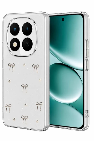 Newface Xiaomi Redmi Note 15 Pro 5G Fiyonk Desenli Kapak - Desen 5 ürün görseli 1