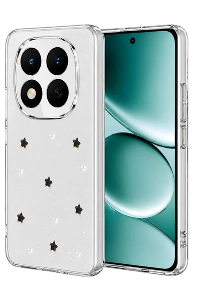 Newface Xiaomi Redmi Note 15 Pro 4G Fiyonk Desenli Kapak - Desen 7 ürün görseli 1