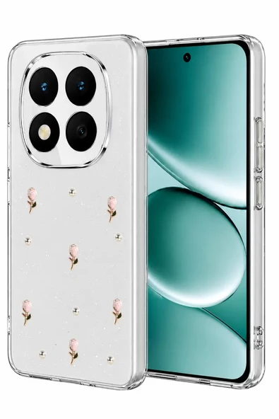 Newface Xiaomi Redmi Note 15 4G Fiyonk Desenli Kapak - Desen 6 ürün görseli 1