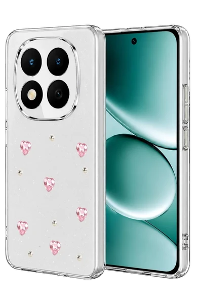 Newface Xiaomi Redmi Note 15 Pro 5G Fiyonk Desenli Kapak - Desen 3 ürün görseli 1