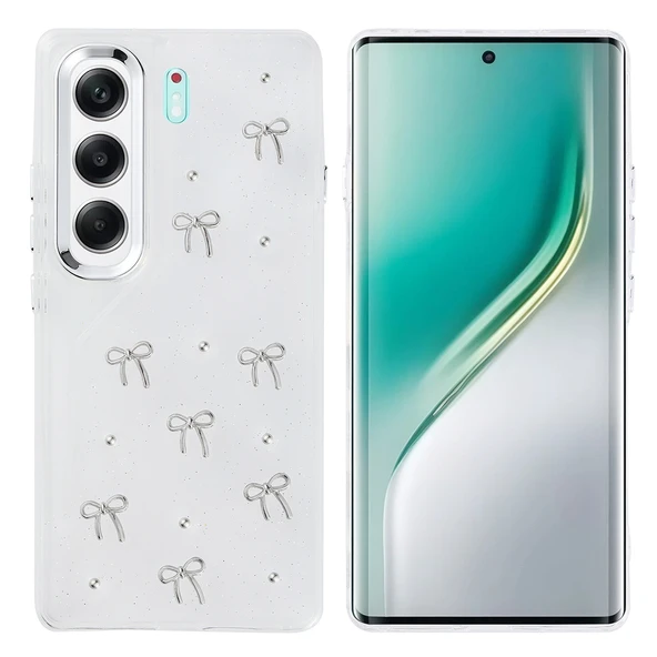 ZenithWorks Tecno Camon 40 4G Kılıf Airbag Tasarımlı Simli Şeffaf ZNTH Kutup Kapak - Fiyonk ürün görseli 1