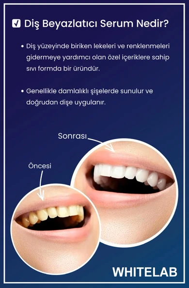 WHİTELAB DİŞ BEYAZLATICI 2'Lİ - Resim 3