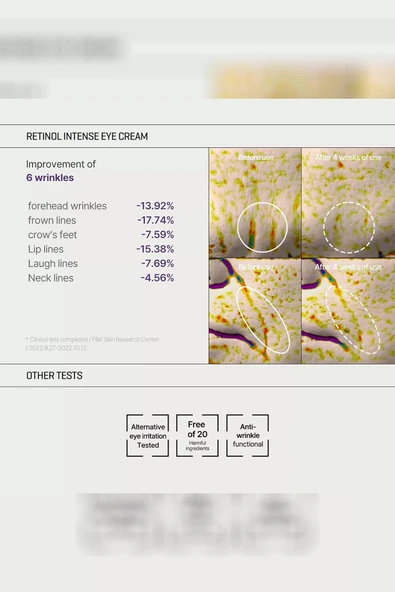 Some By Mi Retinol Intense Cilt Bakım Seti - Resim 5