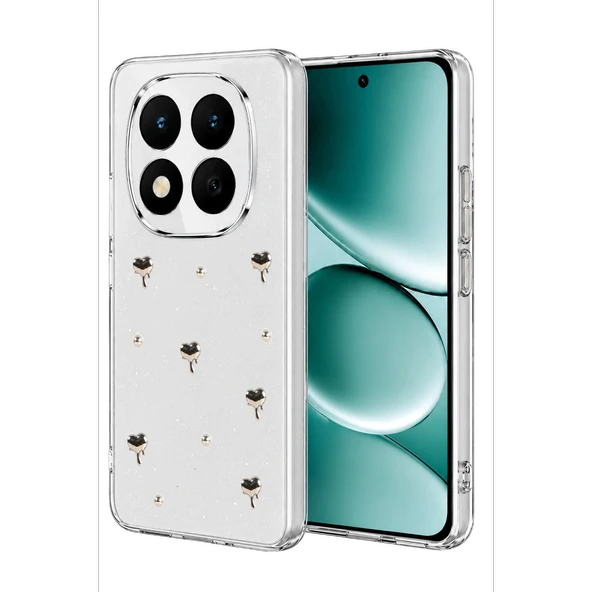 Xiaomi Redmi Note 15 Pro Plus 5g Fiyonk Desenli Kapak - Desen 1 ürün görseli 1
