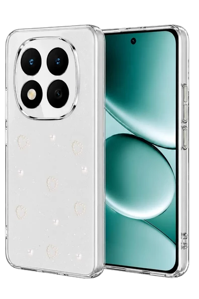 Newface Xiaomi Redmi Note 15 4G Fiyonk Desenli Kapak - Desen 10 ürün görseli 1