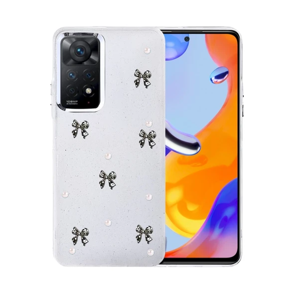 Xiaomi Redmi Note 11 Pro Fiyonk Desenli Kapak - Desen 8 ürün görseli 1