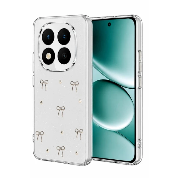 Xiaomi Redmi Note 15 Pro 4g Fiyonk Desenli Kapak - Desen 5 ürün görseli 1