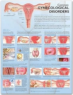 Common Gynecological Disorders Anatomical Chart ürün görseli 1